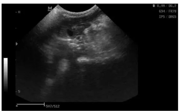 Figure 2. Ultrasound image of the liver of laboratory rats (transverse section). (B)