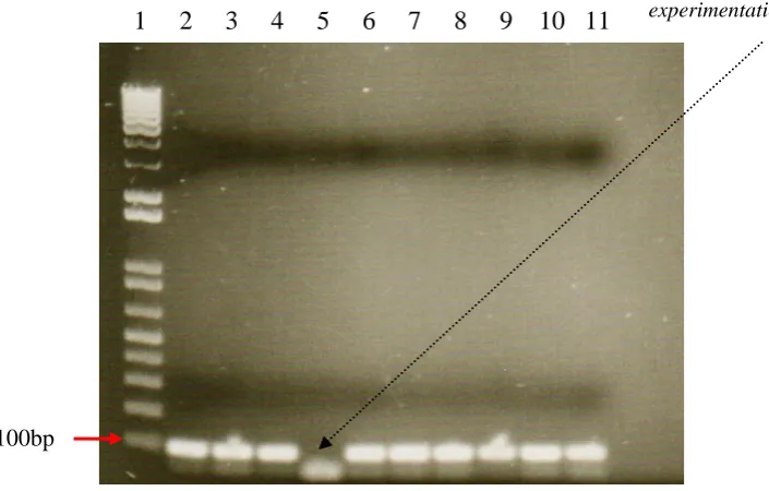 Figure 3: PCR agarose gel showing presence of the P. aeruginosa elastase (LasB) 