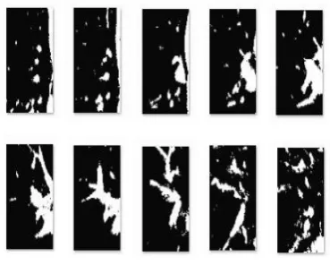 Fig 6:   A/V fused images of one patient 