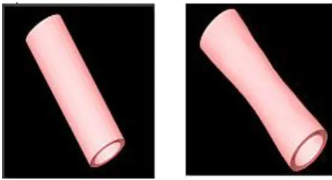 Fig 10:  Comparison of normal image with arteriosclerosis image 