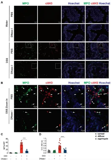 Figure 3. DNase I treatment significantly degrades NET structure in the colon of mouse fed DSS