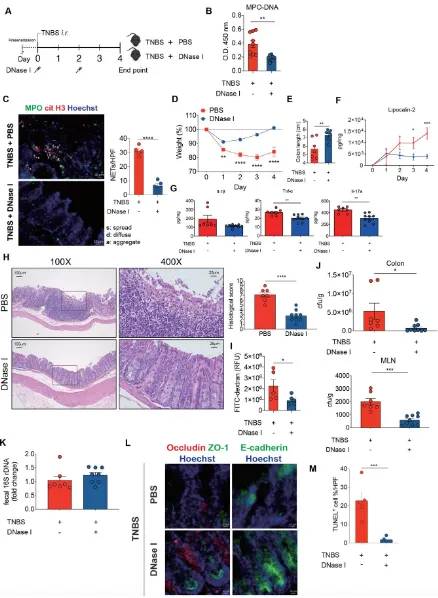 Figure 6. DNase I administration reduces intestinal inflammation and restores intestinal barrier function in mice with TNBS-induced colitis
