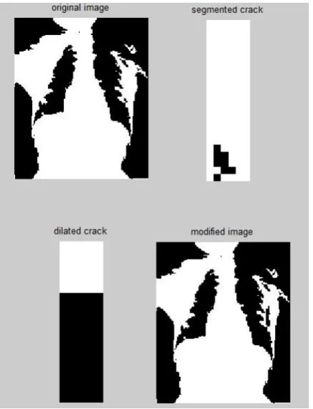 Figure 3: Ankle X-Ray Image 