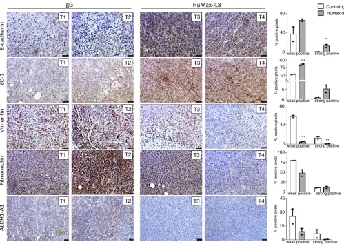 Figure 3. Neutralization of IL-8 reduces features of mesenchymalization and stemness in vivo