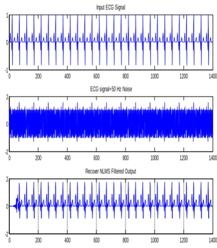 Fig. 11  LMS algorithm where µ=0.09, Filter length = 25   