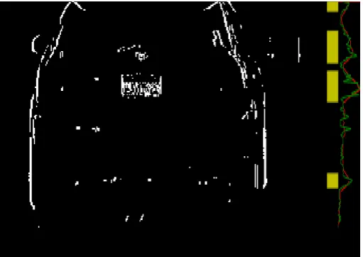 Figure 6. Grayscale HL sub-band car image with row-sum distribu- tion and identified plate candidate regions