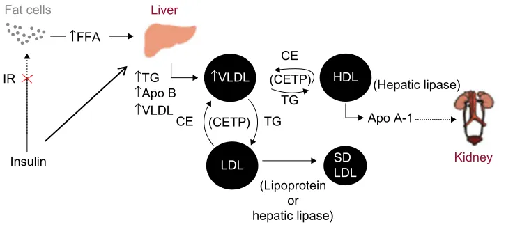Figure 1 Pathogenesis of ADD.Abbreviations: ADD, atherogenic dyslipidemia of diabetes; iR, insulin resistance; FFA, free fatty acids; TG, triglycerides; Apo B, apolipoprotein B; vLDL, very low­density lipoprotein; Ce, cholesteryl esters; CeTP, cholesterol ester transport protein; LDL, low­density lipoprotein; HDL, high­density lipoprotein; Apo A­1, apolipoprotein A1; SDLDL, small dense low­density lipoprotein.
