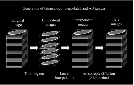 Figure 1. Illustration of generating the thinned-out, interpolated and aniso-tropic diffusion (AD) images from original images