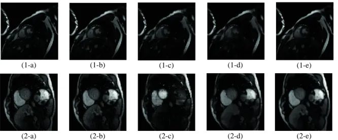 Figure 1.  Reconstructed Images and Original Image for (row 1) Cine and (row 2) Perfusion Data