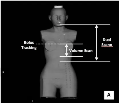 Figure 2. Scan length of dosimetry for coronary CT.      