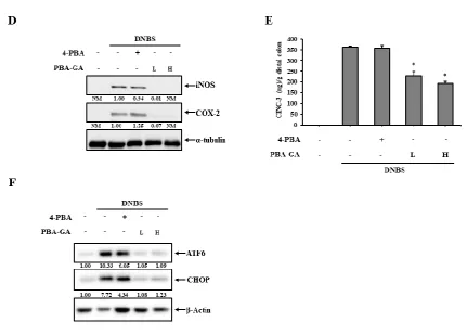 Fig. 3. PBA-GA ameliorates DNBS-induced rat colitis by attenuating ER stress.  (A) Human colon epithelial cells, NCM460, were treated with 4-PBA at various concentrations for 24 h and were then challenged with the ER stress inducer, tumicamycin (TM, 1g/mL