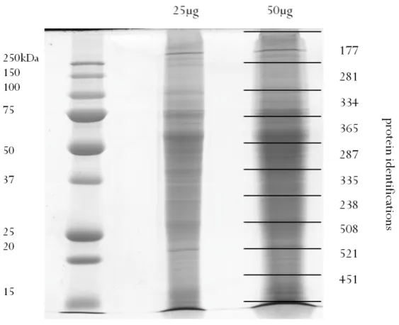 Figure 2.4: 1-DE gel of tachyzoite lysates for Orbitrap. Samples were analysed on a 12 % (w/v) acrylamide gel under denaturing conditions, visualised by Colloidal Coomassie staining