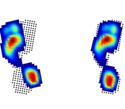 Figure 2.7: Registration of foot pressure records transforms each record to align with a template print