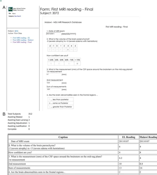 Figure 2NeuroInterp work screen for reading and adjudication