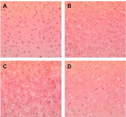 Figure 5 Oil red O staining of liver tissue from hamsters fed on hyperlipidemic filled with microvesicular and/or macrovesicular fat deposits; they are depicted as diets