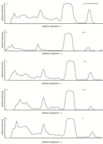 Fig. 1. Electrophoregrams of CSF from:   a) N – control subject, b) PRN – polyradiculoneuritis,  