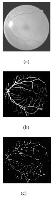 Fig 3: Retinal vessel Segmentation illustrated for one image from the test set. (a) Original test image