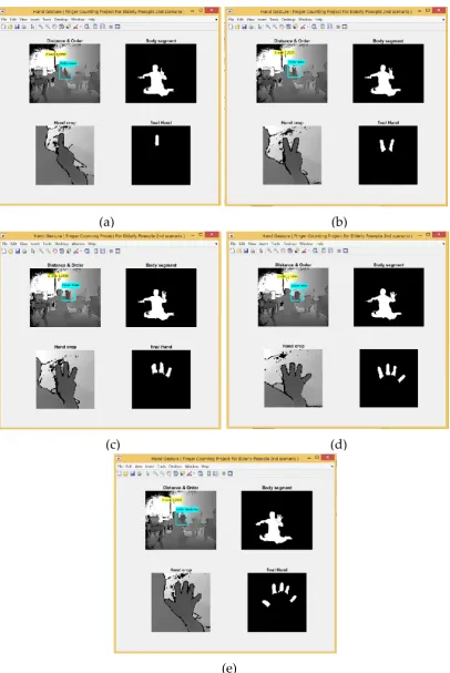 Figure 5. Finger count interpreted as patient requests (a-b-c-d-e). (e) 