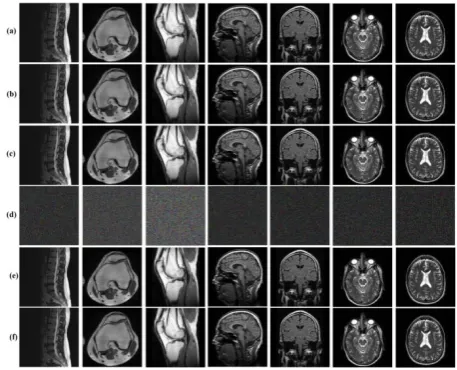 Fig 7: (a) The original medical images, (b) The images after embedding process, (c) The approximated images (d) 