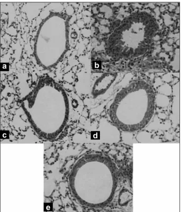 Table 3: Effect of  Taxus baccata  on compound 48/80  induced mast cell degranulation