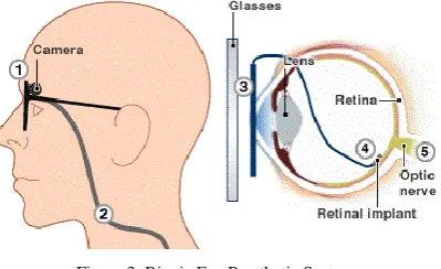 Figure 4: (a) Artificial Silicon Retina  