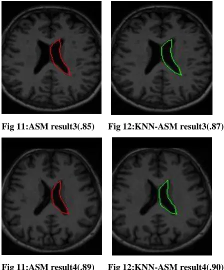 Fig 6: KNN-ASM Framework 