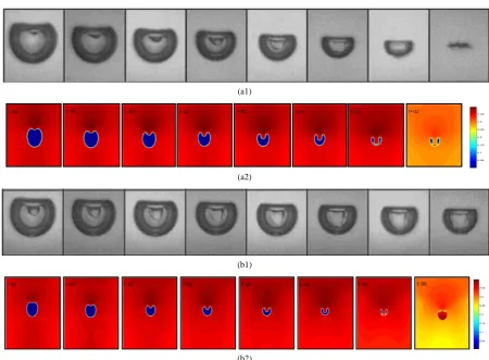Figure 4. (Color online) The collapse process of bubble shape and 2D pressure field evolution (λ =1.5, R0 =80, ∆P=0.0165)
