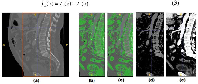 Fig. 2. Edge enhancement. (a) Original slice in sagittal view (image area inside the rectangular box of (a) is displayed)