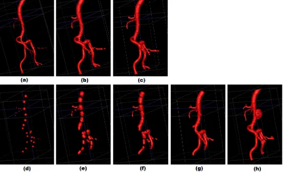 Fig. 5. Intermediate evolution results: comparison between our approach and SNAP. (a)-(c) our approach, showing results of (a) initial segmentation (b) at 60 iterations (c) at 115 iterations
