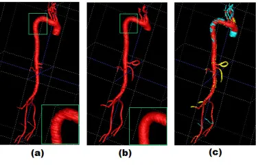 Fig. 7. Visualization of the differences between our result and the manual segmentation result on case STM002
