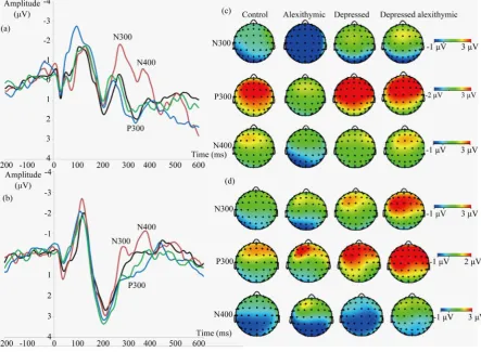 Figure 1. Participant N300, P300 and N400 ERP components reflecting stages of emotional processing grouped by partici-pant group at electrode site Pz, which best reflects experimental effects in all components for the normative database (N = 48)