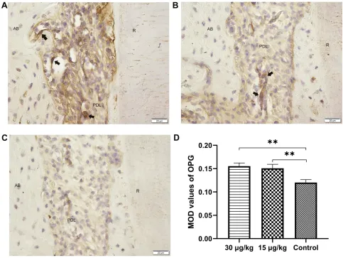 Figure 10 Expression of OPG in the compression side of distopalatal root of maxillary molar.optical values of OPG