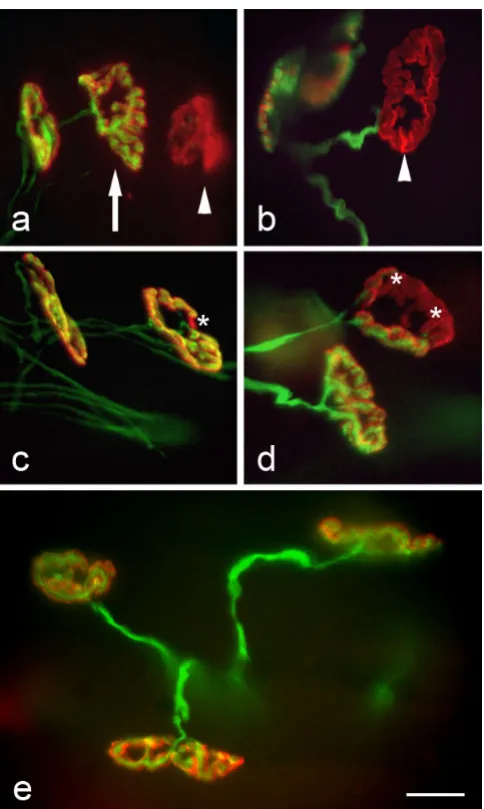 Figure 1M). Both 'occupied' (a: arrow) and 'unoccupied' (a: endplates with intact presynaptic axons (b)