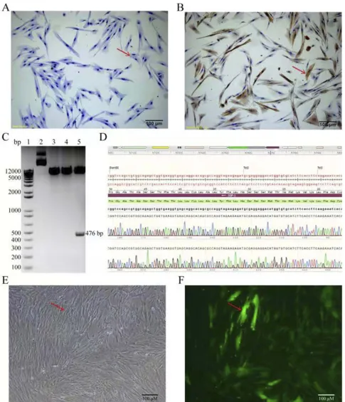 Figure 1 IdentiActin positive staining (100) (under bright-ﬁcation of human uterine leiomyoma cells and infection with IGF-1 lentivirus vectors