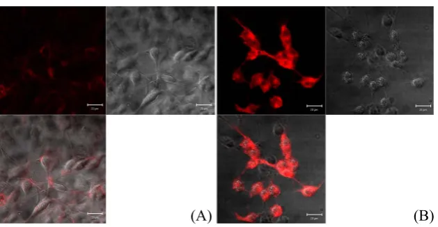 Figure 6. The appearance of melanin in melanoma cell increased as a function of time of exposure to the MUKARB mag-netic pattern (100×)