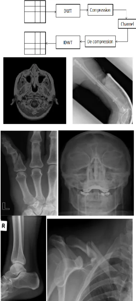 Figure 7. Medical images for compression and decompression 
