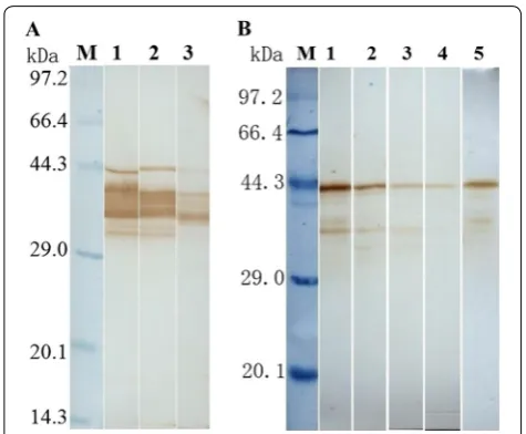 Figure 2 Western blot analysis of TsSP expression in diverse T. spiralis phases. A Western blotting of ES proteins of diverse T
