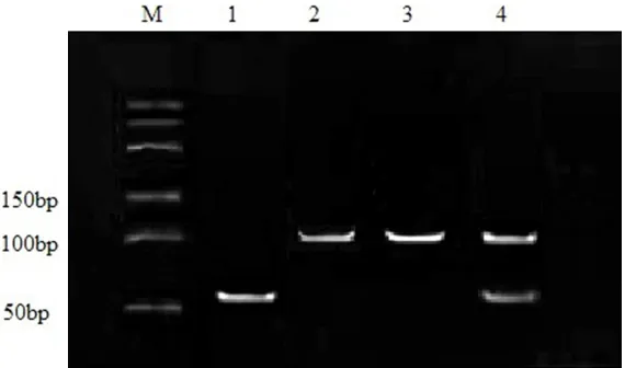 Figure 1. Electrophoregram of PCR products of IL-4 C-590T. M: marker (DNA ladder); lane 1 and 4: TC genotype; lane 2: TT genotype; lane 3: CC genotype.