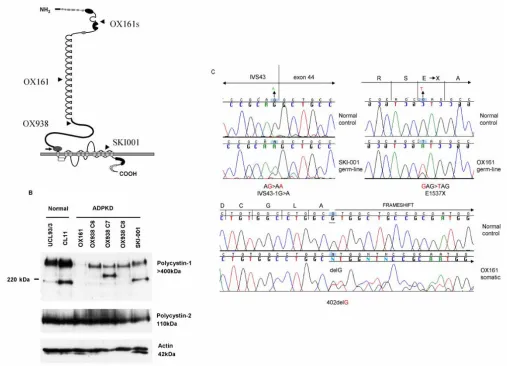 Figure 1. Mutational analysis of PKD1 and PKD2 and characterisation of PC1 and PC2 expressionin ADPKD cystic epithelial cell lines(A) The germline (and somatic ‘s’) mutations for each cystic line are displayed on the figureof PC1