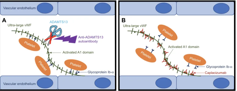 Figure 1 The mechanism of action of caplacizumab.Notes: (A) The pathogenesis of aTTP; the presence of anti-ADAMTS13 autoantibodies inhibits the proteolytic cleavage of ultra-large vwF multimers by ADAMTS13, which results in the aggregation of platelets thr