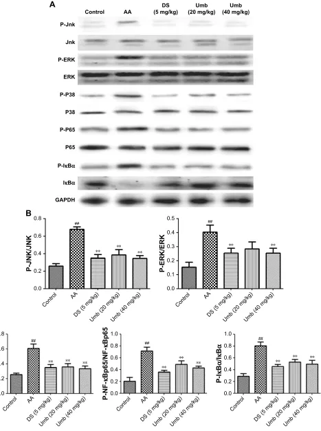 Figure 4 effects of Umb on the expression of MaPK/nF-κB signaling in synovial tissue. Notes: (A) The bands of Western blot
