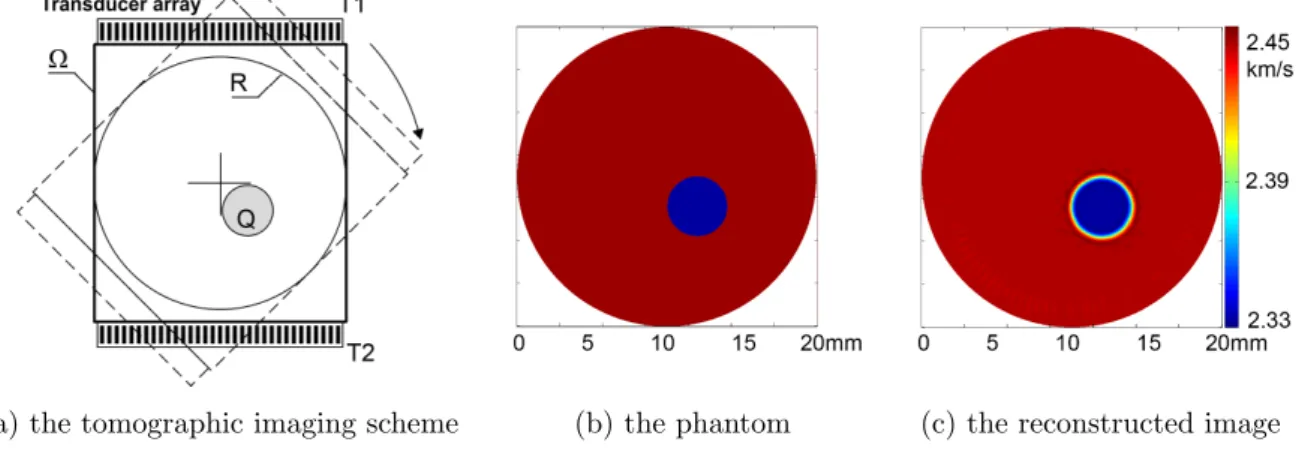 Figure 1. A tomographic examination with rotating transducer arrays