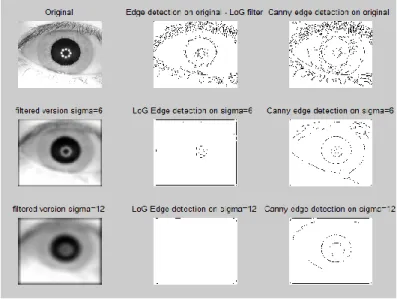 Fig. 6. Edge detection by Canny and Laplacian of Gaussian (LoG) methods. 