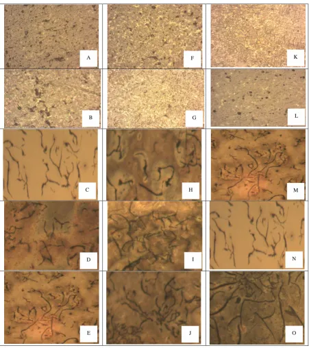 Figure 2. Optical micrographs of sample cast in sand mold. Pouring temperature 1400˚C ×100; (A)-(E) Cast iron containing 0.1% FeSi
