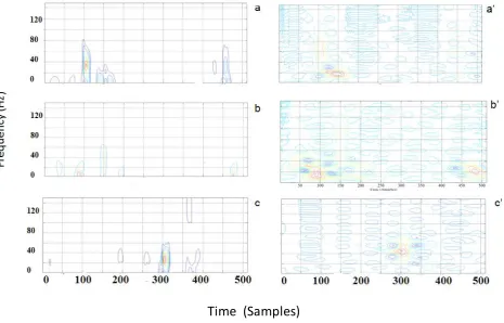 Fig 5: Performance of Variance of various techniques PE, CA, LAG and SPWV of a linear FM signal with length  N = 256 samples 