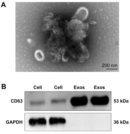 Figure 1 Verification of Exos from BMSCs.Notes: (A) The morphology of exos was analyzed by TeM (scale bar, 200 nm)