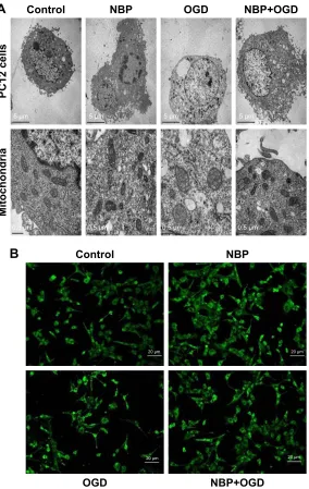 Figure 2 The drug nBP protects Pc12 cells and mitochondria from damage due to OgD.Notes: (A) Ultrastructure of Pc12 cells and mitochondria by transmission electron microscopy