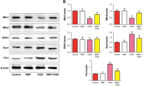 Figure 6 effect of nBP on mitochondrial dynamics in Pc12 cells after OgD.Notes: (A) Western blotting was used to determine relative expression levels of Mfn1, Mfn2, OPa1, Drp1 and Fis1