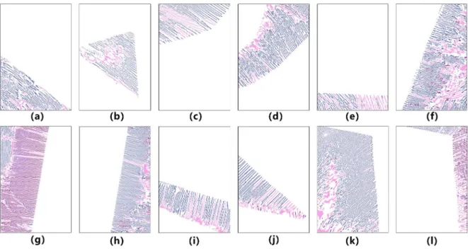 Fig. 11. The classification of microstructural elements in each discrete region. (a) to (l) are twelve regions corresponding to the regions 1 to 12 of row 3 in Fig