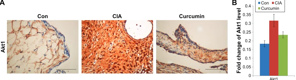 Figure 5 Curcumin alleviated proinflammatory cytokine expression in CIA rats’ serum.Notes: (A) The expression of il-1β and TnF-α in rats’ serum